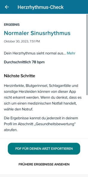 Abruf der EKG-Ergebnisse in der App 2/4